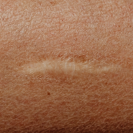 Close up of a white scar