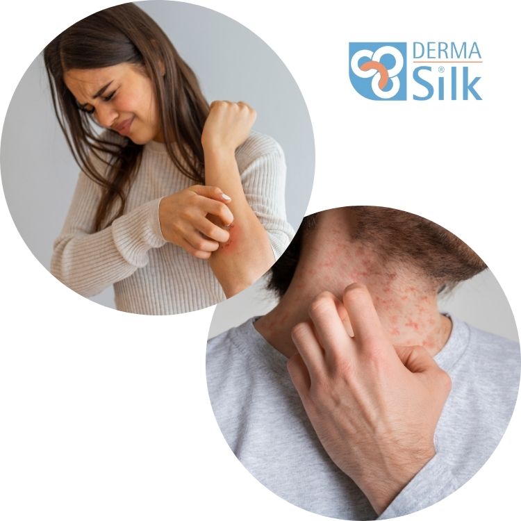 Eczema care with dermasilk