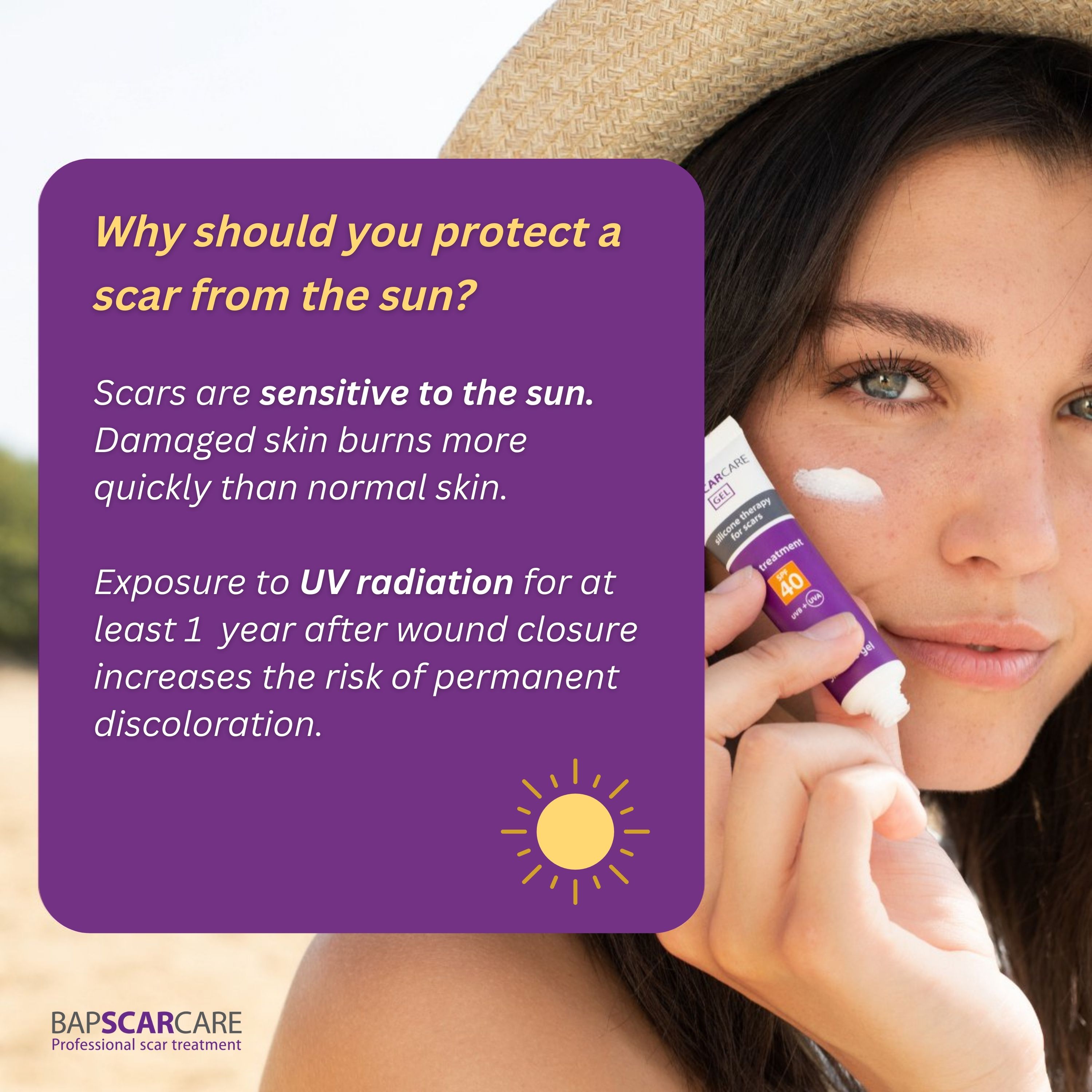 Sun protection is important for your scars