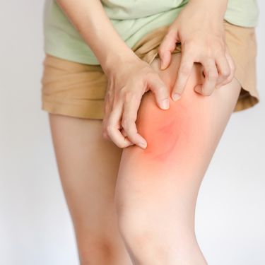 Women have some allergic reactions and itching in the thighs