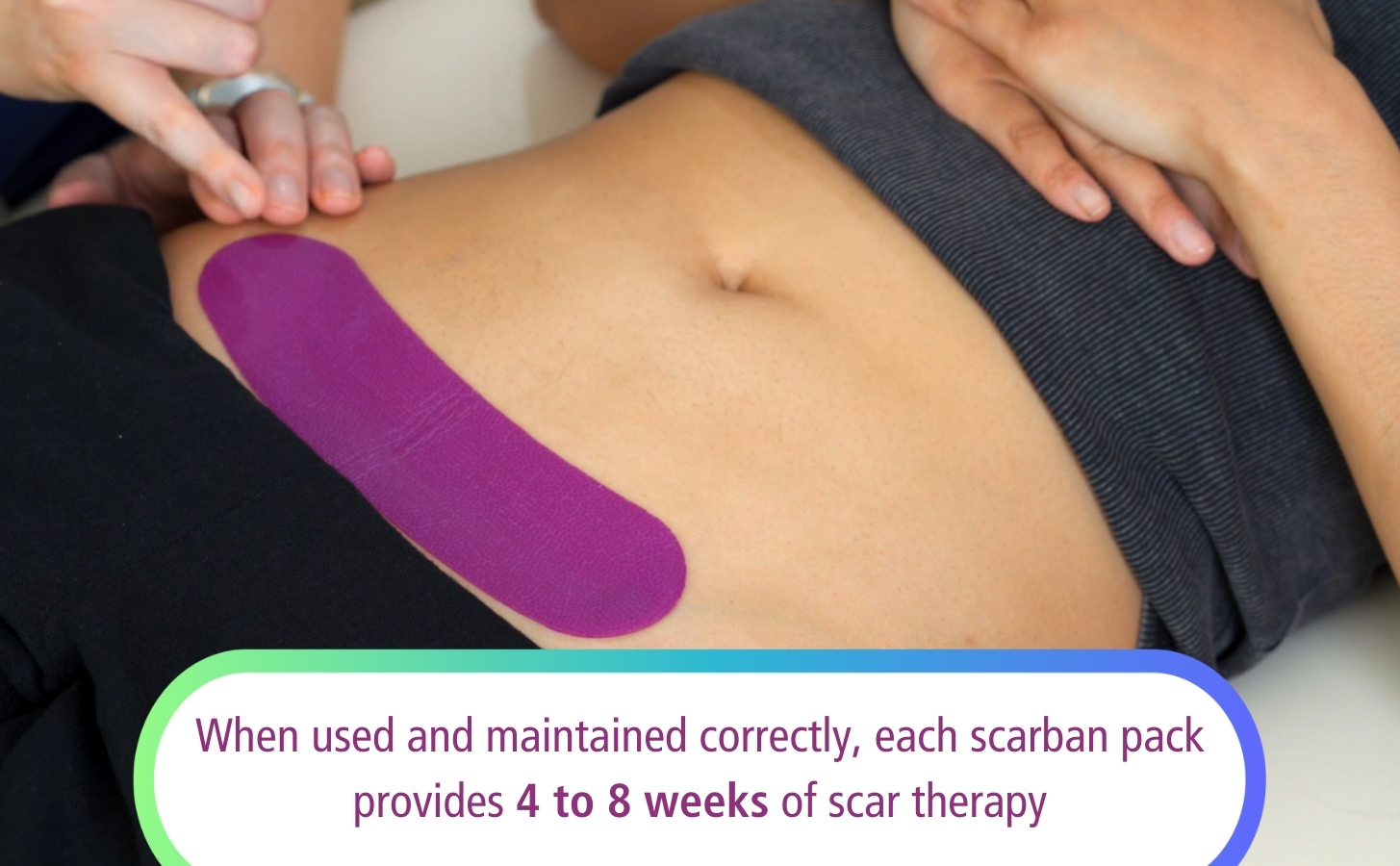 A close-up of a person&rsquo;s abdomen shows a purple scarban silicone sheet applied to a scar. Text states each Scarban pack provides 4 to 8 weeks of scar therapy when used correctly.