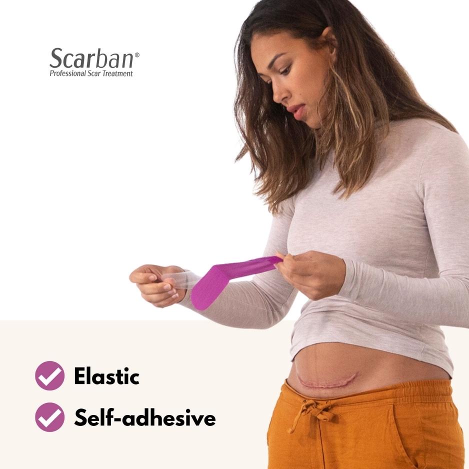 A woman in a beige top and orange pants holds a purple scarban silicone sheet near her C-section scar. Text highlights it as elastic and self-adhesive.