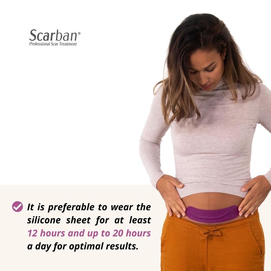 A woman adjusts scarban c section silicone sheet on her abdomen. Text advises wearing it 12&ndash;20 hours daily for best results.